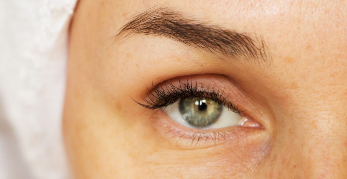 12 Ways to Remove Under Eye Wrinkles